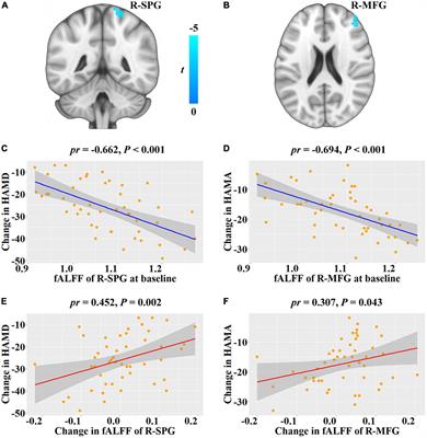 Neural mechanism of the relationship between sleep efficiency and clinical improvement in major depressive disorder: A longitudinal functional magnetic resonance imaging study